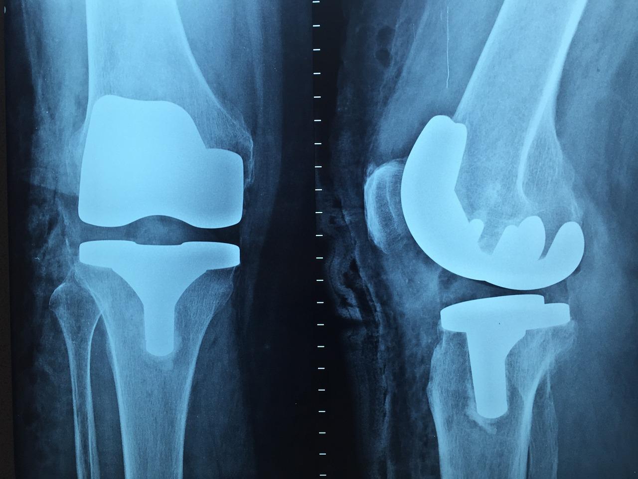 Orthopedie in Heerhugowaard